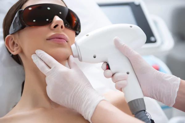 Laser hair removal